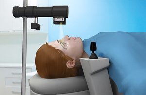 corneal-cross-linking-for-keratoconus